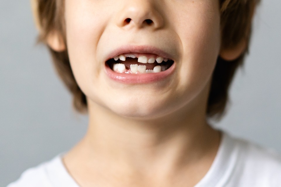 Dent de lait grise chez l’enfant : 4 solutions efficaces pour rassurer et agir
